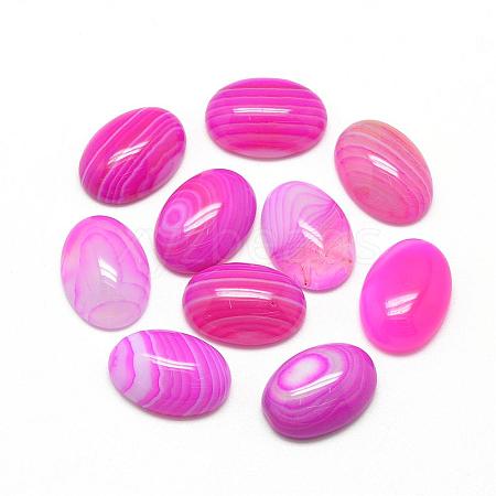 Natural Striped Agate/Banded Agate Cabochons G-R415-13x18-13-1